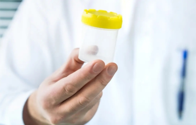 detectan-el-primer-caso-de-transmision-de-una-enfermedad-rara-mediante-donante-de-esperma-57980